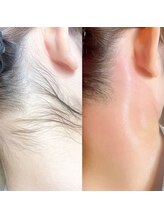 エトレ(ETOLE)/うなじワックスも大人気です！