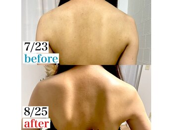 アモ(amo.)/肩甲骨出し