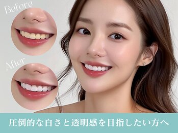 ジュエルホワイトニング/圧倒的な白さと透明感!