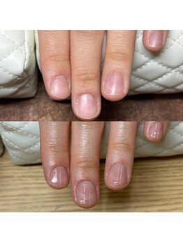 リリ(lili)/トータルハンドケア1回目