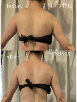 エクラ 五反田(eclat)/肩こり巻き肩首コリ背中痩せ