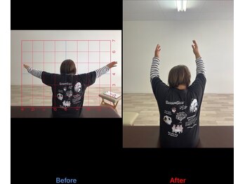 ストレチックス 近江八幡店/BeforeAfter