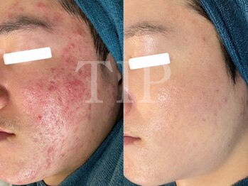 22クラレ(22curare)/どんなお肌の悩みにも対応します