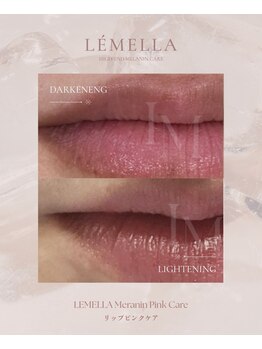 ミリノ(Salon MIRINO)/たった1度の施術で♪