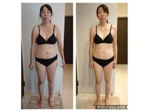 アンクール(esthetic salon uncoeur)/ダイエットエステモデルさん