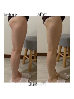 オン(On)/むくみスッキリ☆ボディコース