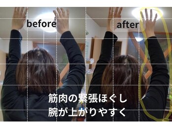 安達カイロプラクティックオフィス/右腕可動域が広がり上がりやすく