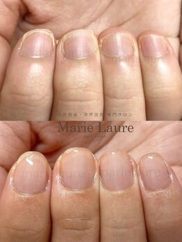 マリーロール 梅田店(Marie Laure)/深爪矯正/自爪育成/自爪風