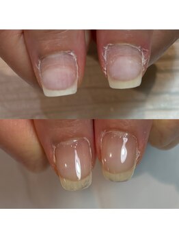 キュア(Cure.)/他サロンでは育成出来ずご来店