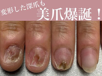 トレフル(Trefle)の写真
