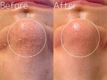 マイナプラ 表参道(myna+)/