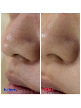 エミタス整骨院/継続することでお肌のツヤアップ