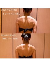 凪 横浜/肩こり3回での変化　