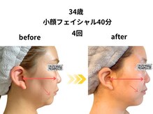 アルピナ(ALPINA)