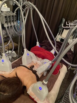 ブルースター(Blue Star)/脂肪冷却8カップ施術風景