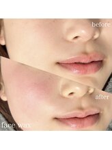 モストアイズ 新宿(most eyes)/フェイスワックス！パリジェンヌ