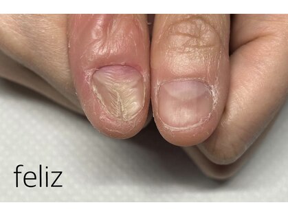 フェリス(Feliz)の写真