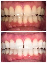 ライトビューティー 池袋店(LightBeauty)/将来写真