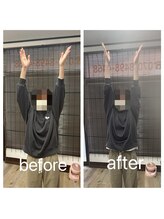 アンティオール 古河店/肩の痛みに！【古河　整体】