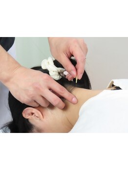 鍼灸施術を受けたい