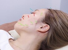 ボディケアプラス(Bodycareplus)