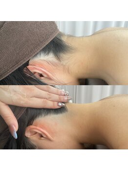 ミース 北九州店/うなじ＊ビフォーアフター