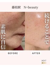 エヌプラスビューティー(N+beauty)/回数を重ねるごとに自信