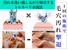 長年毛穴汚れの悩みは月1回～2回の施術を3～4ヶ月で完全解決！