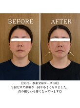 ヨサパーク ハグ 北野(YOSA PARK hug)/リバウンドのないダイエット！