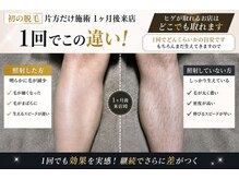 モデルズ(MODELS)の雰囲気（ヒゲが抜けるお店はどこでも効果出せます。#メンズ脱毛松山）