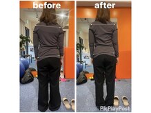 カワル整体 上通り院/真っ直ぐ立っている"つもり"