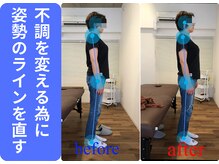 広島ミライエ整体院(広島MIRAIE整体院)/不良姿勢が気になる