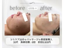 アリス 心斎橋店(alice)/マッサージ付きシミケア20分