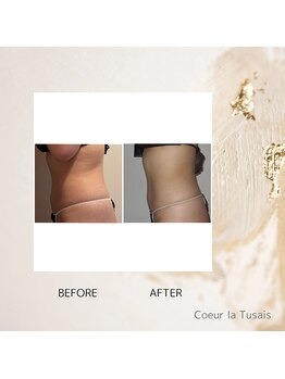 クーラ テュセ(Coeur la Tusais)/痩身ぽっこりお腹に