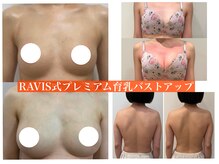 ヌードに自信！2カップ以上バストアップ、姿勢も整う新技術！