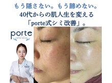 40代からのシミケア.痩身専門サロン porte by Harmo【3/17 NEW OPEN(予定)】