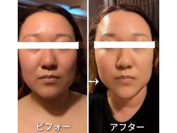 西院アロマリラクゼーションサロン シャルール/脂肪分解 レモンボトル大人気!