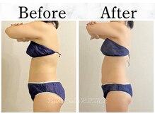 リルチェ 自由が丘(RILUCE)/40代　女性