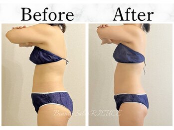 リルチェ 自由が丘(RILUCE)/40代　女性