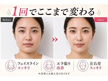 マイスター整体院 天神院の写真/【国家資格者が施術】小顔ケアと同時にほうれい線・たるみケアをしたい方へ【西鉄天神駅/天神南駅 3分】