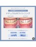 6月限定《梅雨の延長月間》 高濃度ハイパワーホワイトニング◯通常40分→45分