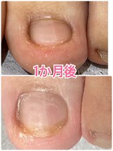 グレースレディ 神戸北店/