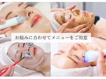 シフォン(Chiffon)の雰囲気（お肌悩みがある方はぜひ効果を体感して素肌に自信を持ちましょう）