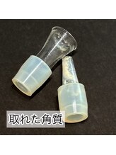 イリス(Iris)/詰まりを取ったら美容液をin☆