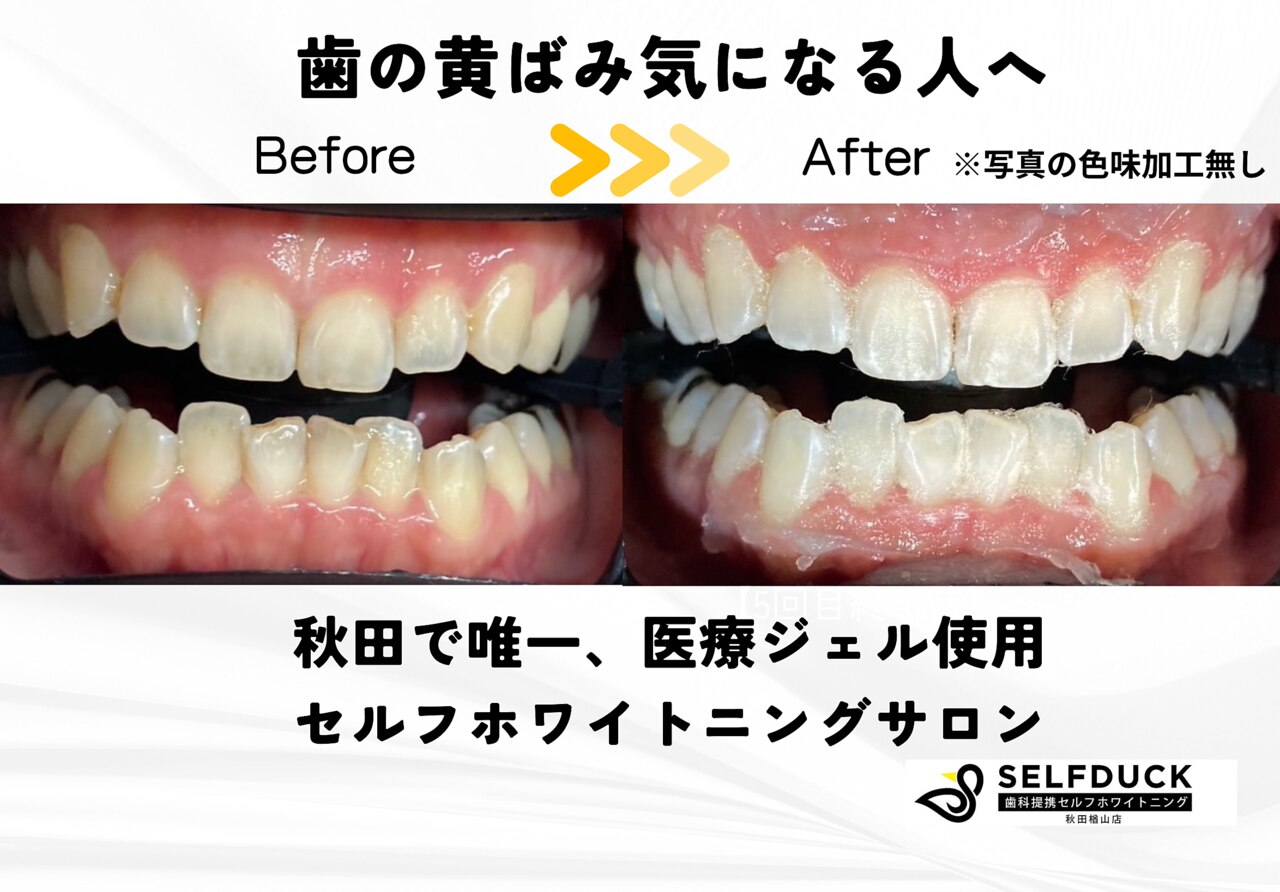 セルフダック ビューティーラグーン 秋田楢山店(SELFDUCK