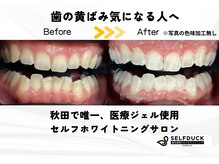 セルフダック ビューティーラグーン 秋田楢山店(SELFDUCK BeautyRaccoon)