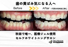 セルフダック ビューティーラグーン 秋田楢山店(SELFDUCK BeautyRaccoon)