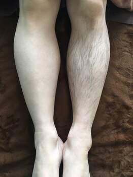 1回ごとにお支払い可能なサロン