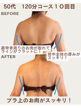 リウル(RiUll)/ブラ上・脇のハミ肉スッキリ！