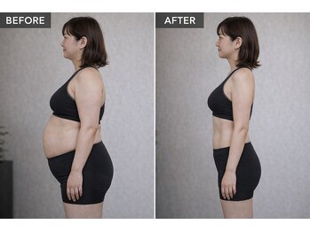 アプロ(Aphro)/下腹が気になる方へ